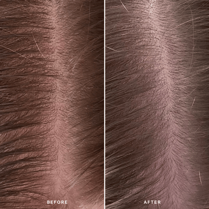 Alpha-H Healthy Scalp Exfoliating Treatment 100ml